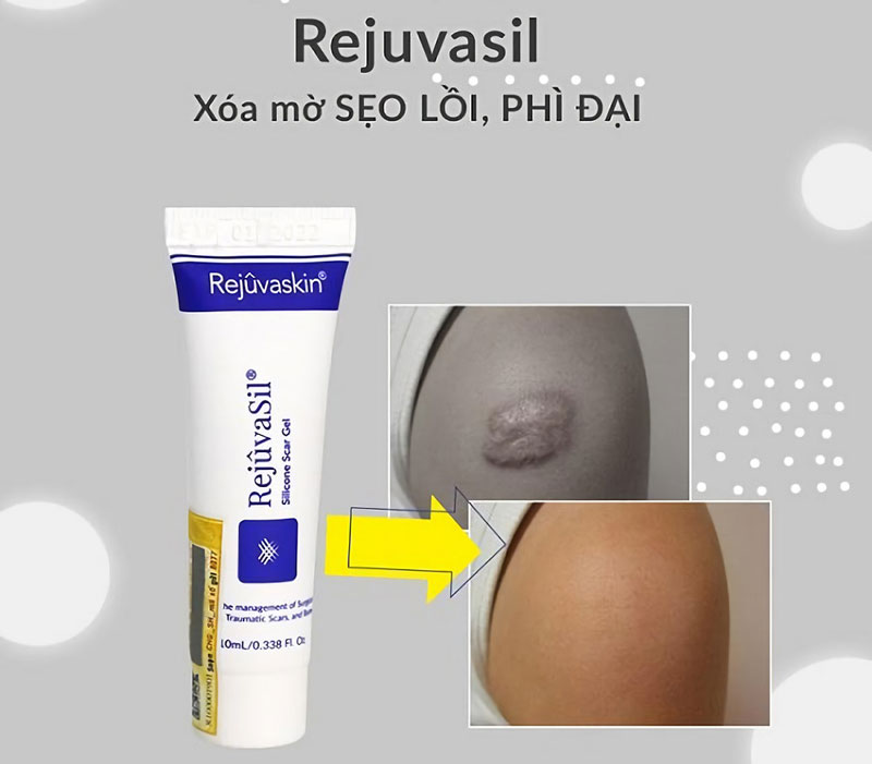 Thuốc bôi trị sẹo Scar Rejuvasil