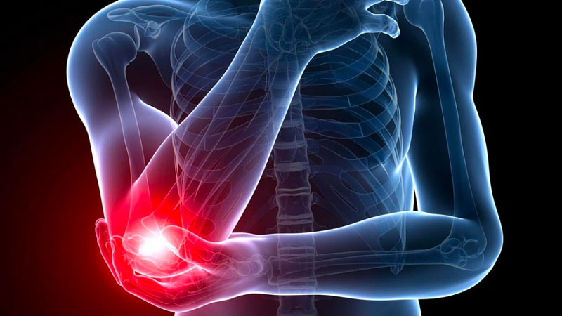 Những chấn thương khuỷu tay cũng khiến cho vùng khớp này bị đau nhức