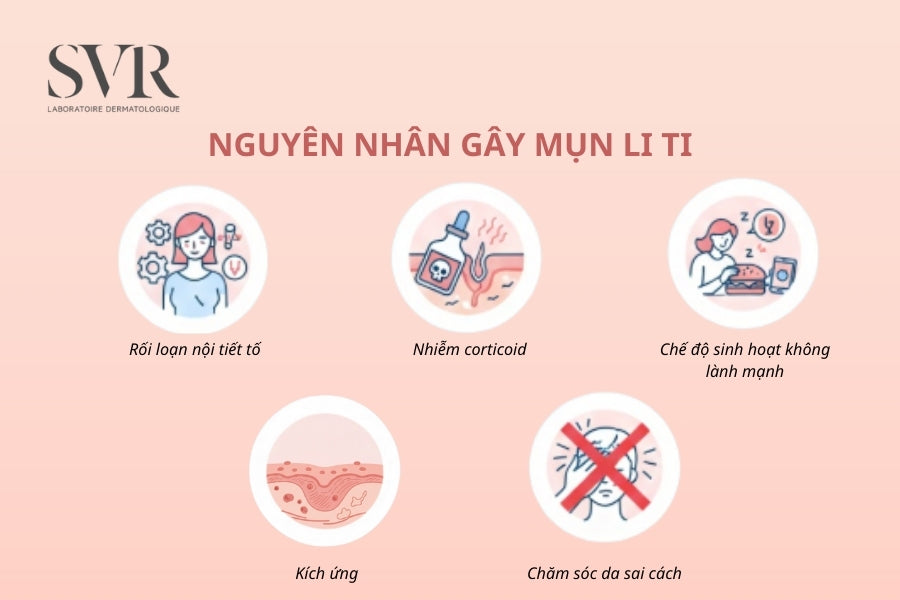 Nguyên nhân hình thành mụn li ti