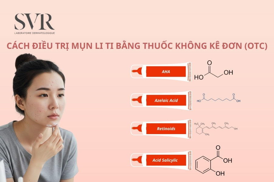 Cách trị mụn li ti tại nhà bằng thuốc không kê đơn