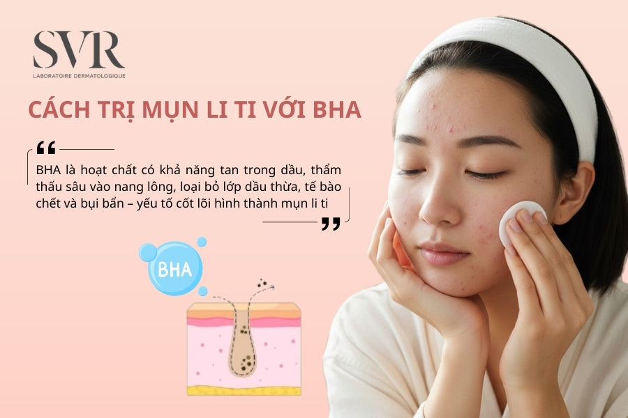 Cách trị mụn li ti với BHA