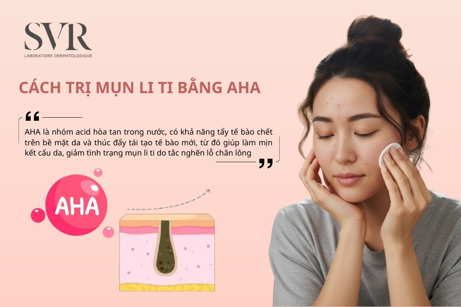 Cách trị mụn li ti bằng AHA