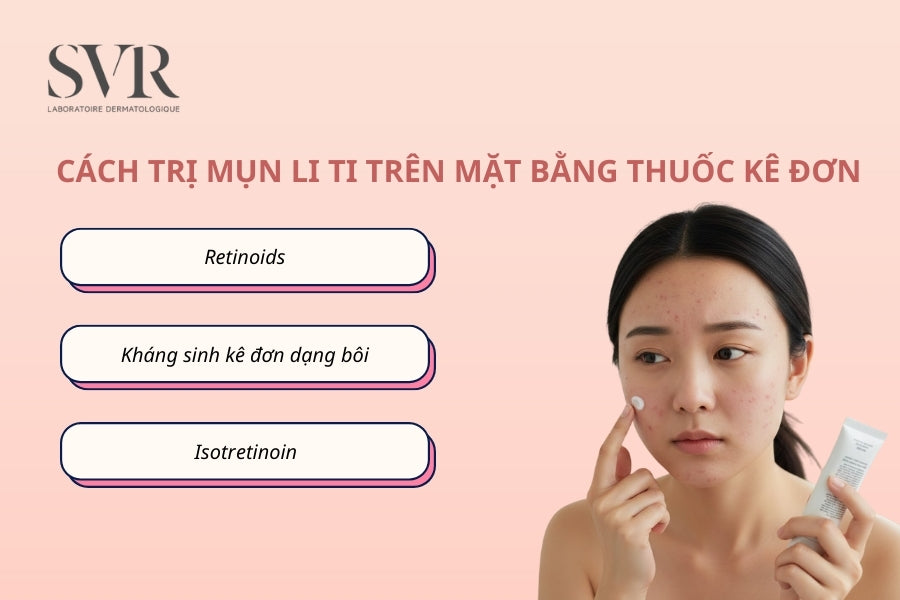Cách trị mụn li ti trên mặt bằng thuốc kê đơn