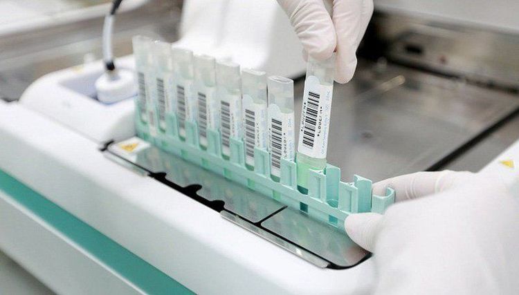 Một số xét nghiệm giúp kiểm tra tình trạng phân màu đen của người bệnh.