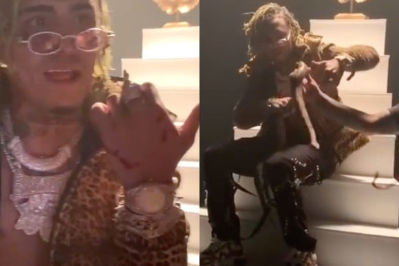 Lil Pump bị rắn cắn ảnh 1